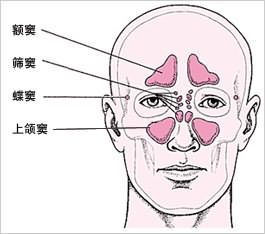 鼻窦可分为额窦,蝶窦,筛窦,上额窦.